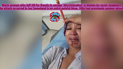 SO CALLED BLACK WOMAN LEFT U.S. BEATEN BY RUSSIA RACIST