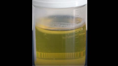 My First Morning Pee Smells Like Wellness Clues