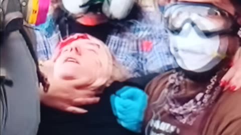 Clown protester shot in head with rubber bullet
