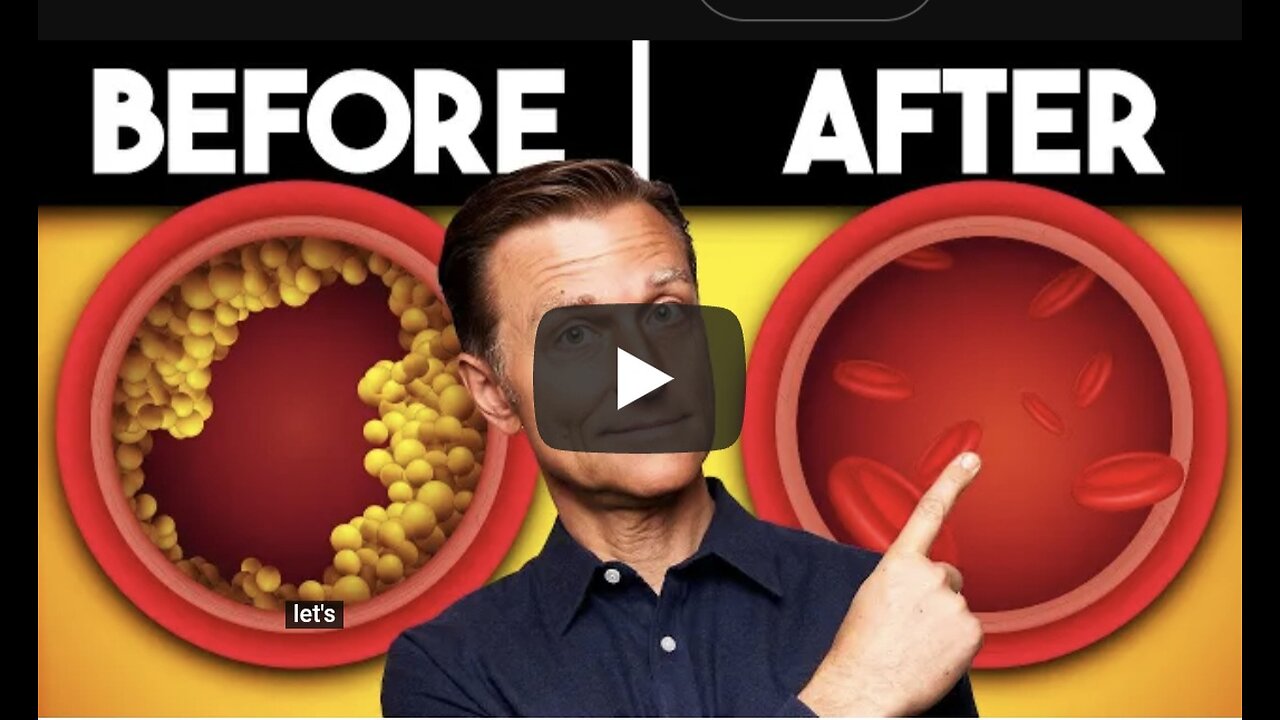 The Best MEAL to Clear Out Your Arteries