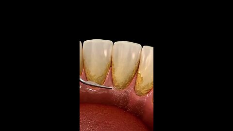 One Simple Trick to Instantly Whiten Your Teeth (No Strips, No Dentist)