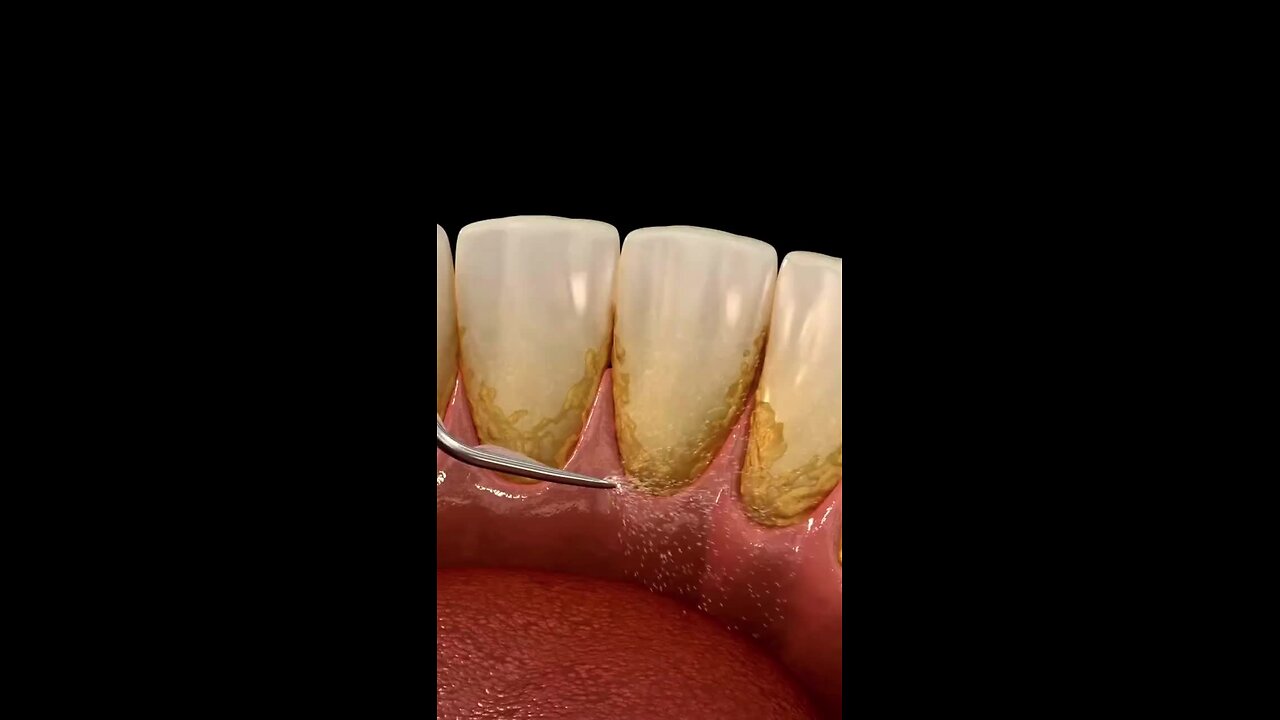 One Simple Trick to Instantly Whiten Your Teeth (No Strips, No Dentist)