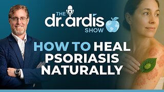 The Dr. Ardis Show | How to Heal Psoriasis Naturally | Episode 05.14.2025