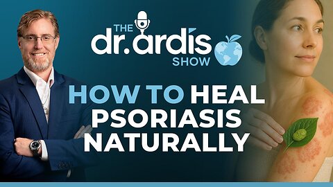 The Dr. Ardis Show | How to Heal Psoriasis Naturally | Episode 05.14.2025