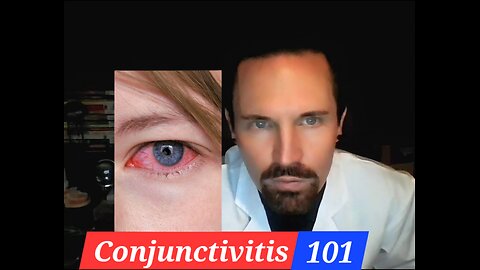 Conjunctivitis 101 The Basics