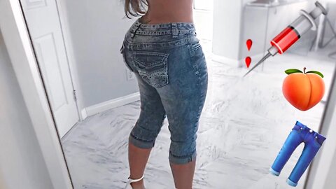 Brazilian Butt Lift!? | MISSSPERU