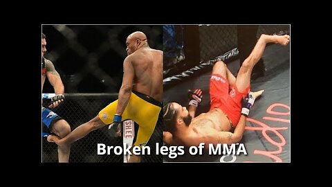 The Shocking Reality of MMA Bouts: Horrible Broken legs Inside the Octagon