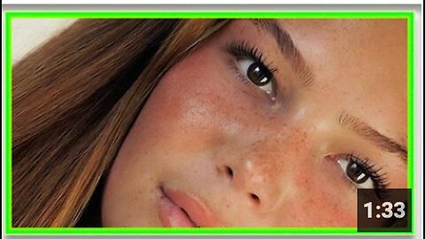 "Model's Skull Severely Affected by Vaccine-Induced Brain Cancer"