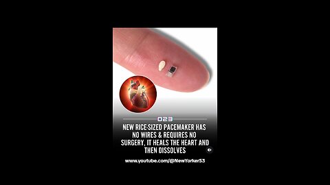 Wireless Pacemakers