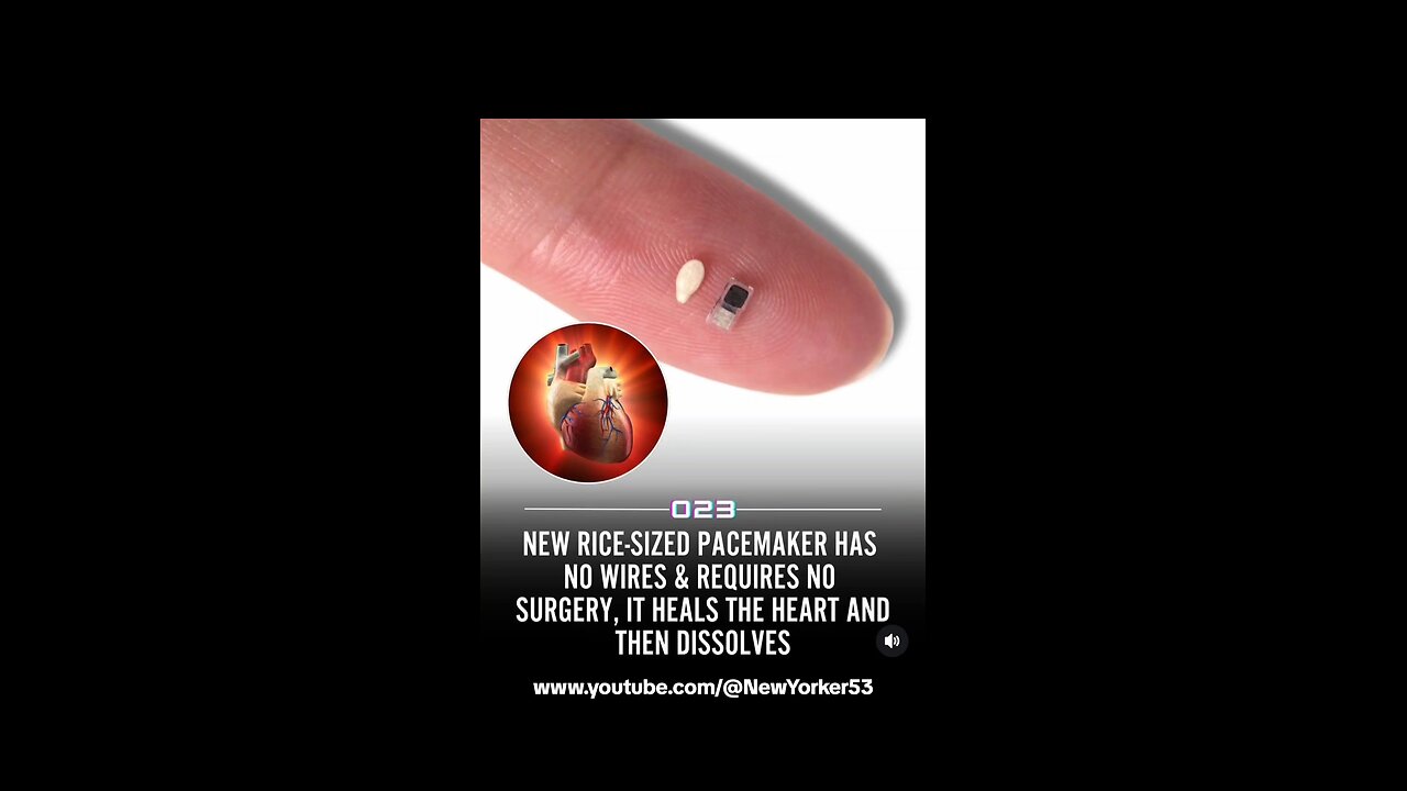 Wireless Pacemakers