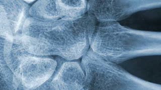 The Pill Only Delays Problems Until Later... with Elizabeth Katzman