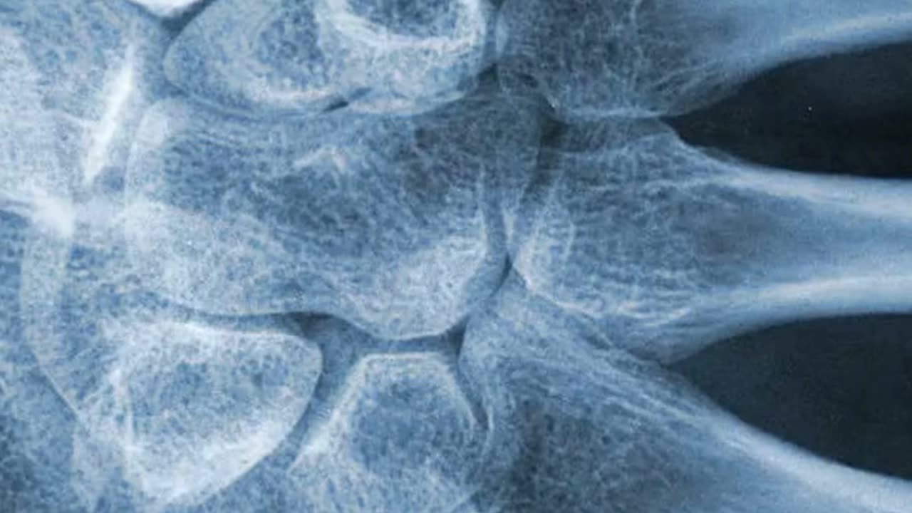 The Pill Only Delays Problems Until Later... with Elizabeth Katzman