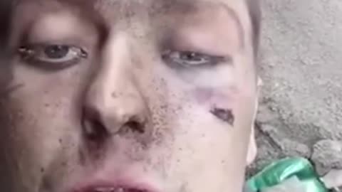 😢⚠️ Ukraine Russia War | Wounded Russian Soldier's Final Testimony | RCF