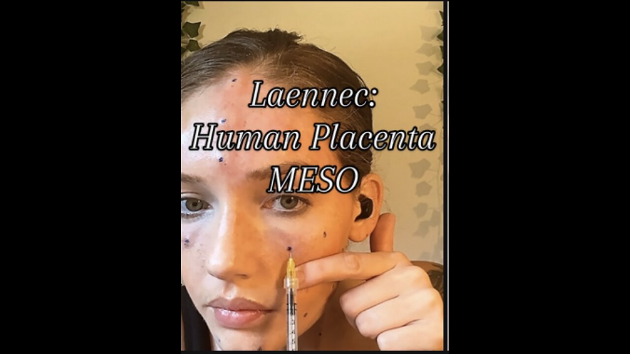 Laennec: Human Placenta Meso for Acecosm’s 1 day sale! 20% off with code Heather10