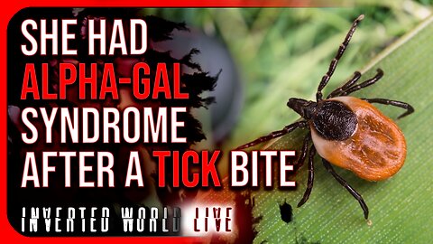 She Had Alpha-Gal Syndrome After a Tick Bite