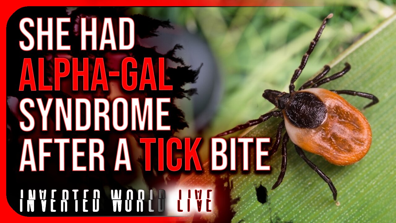 She Had Alpha-Gal Syndrome After a Tick Bite