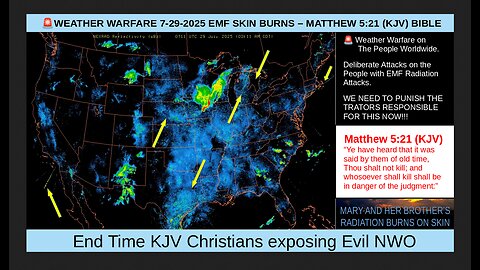 NEXRAD data for 7-28-2025 - 7-29-2025 & EMF Radiation Skin Burns