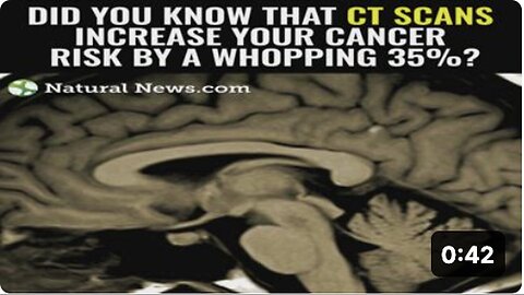 "CT Scans Increase Cancer Risk by a Whopping 35%"