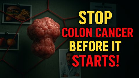 The #1 Food to Slash Colon Cancer Risk (You’re Not Eating Enough!)