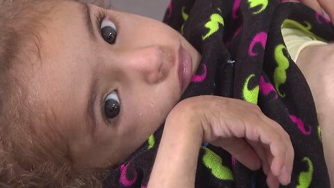 Gaza’s main hospital is overwhelmed with children in pain from malnutrition