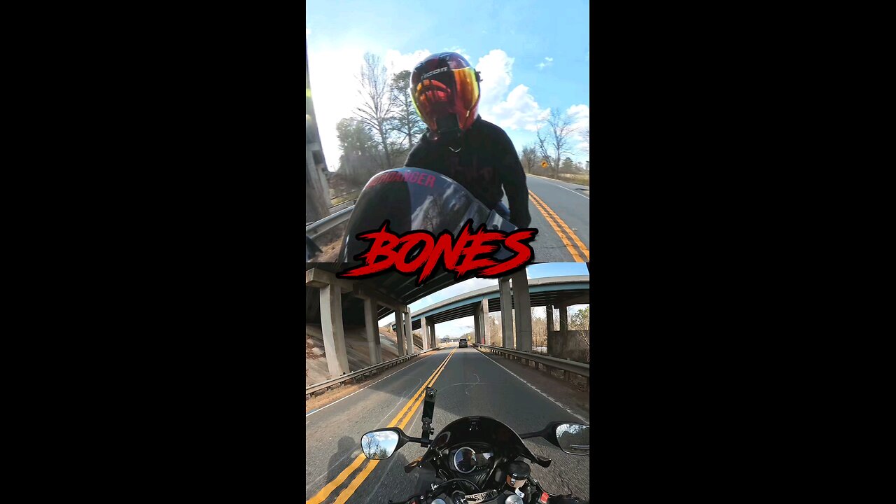 I Have So Many Bones!