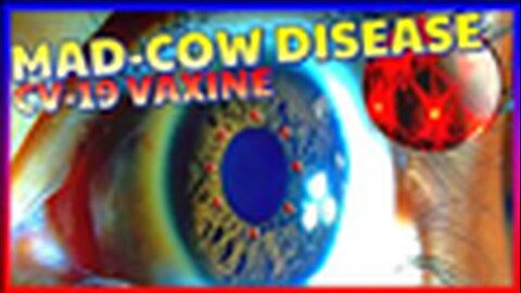"Understanding the Potential Impact of CV-19 Vaccine on Prion (Mad Cow) Disease"