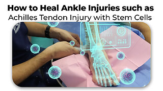 How to Heal Ankle Injuries such as Achilles Tendon Injury with Stem Cells