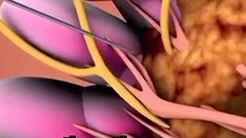 "Unlocking the Anti-Cancer Potential of Bee Venom: A Breakthrough in Treatment"
