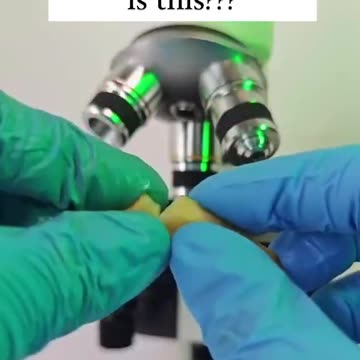 💥⚠️🔥☠️🔥⚠️💥 Fast food is loaded with parasites... Get some ivermectin today..!!!