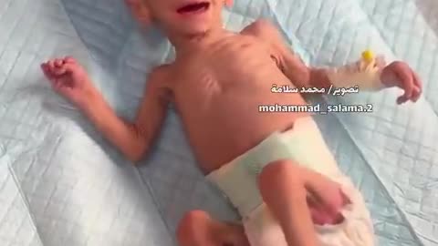 Entire Gaza population at critical risk of famine