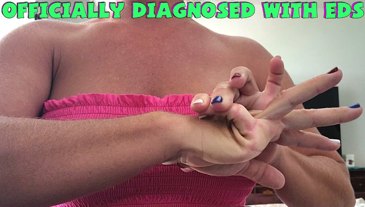 IT'S OFFICIAL...I HAVE BEEN DIAGNOSED WITH EDS