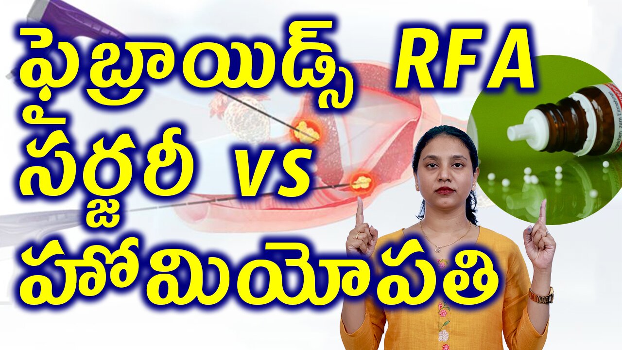 ఫైబ్రాయిడ్స్ RFA సర్జరీ VS హోమియోపతి Homeopathy vs Fibroids Removal Surgery Radio Frequency Ablation