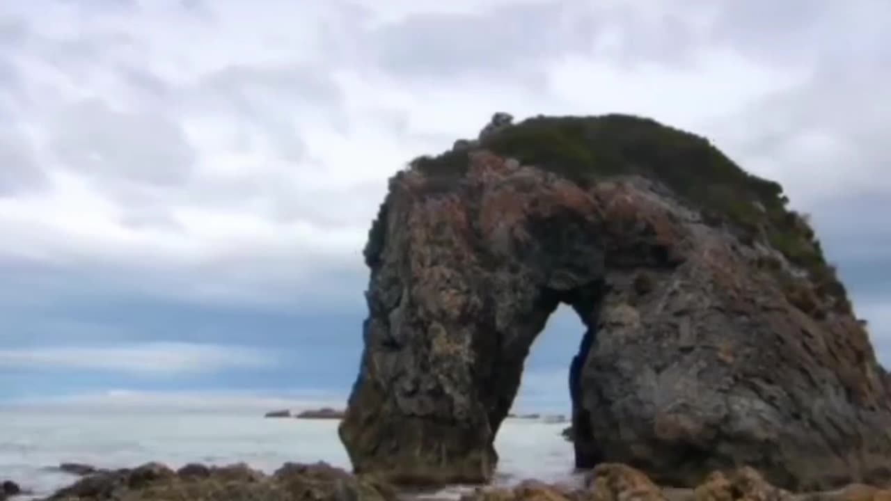 NORMAL BONE MATRIX