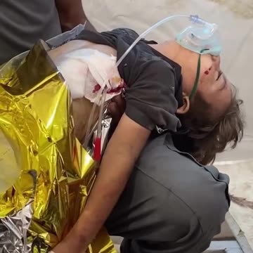 Five-year-old Ramadan Abu Warda survived the bombing of his home