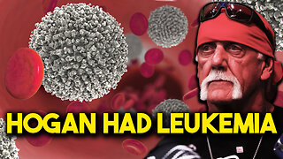 Hulk Hogan had Leukemia? - Bubba the Love Sponge® Show | 8/01/25