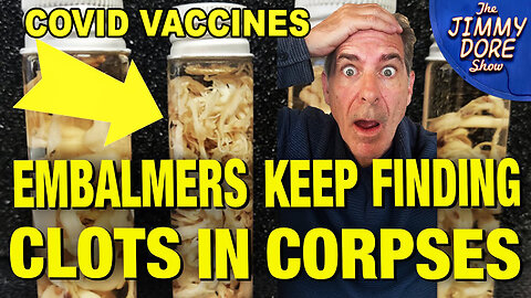 Embalmers Report Persistent Blood Clots in Corpses - Since Covid Vaccine Roll Out