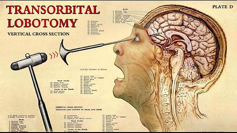 # 1 Psychiatry