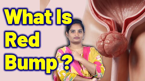 Burning Pain, Or Redness At The Urinary Opening | Urethral Swelling, Urethral Caruncle | Homeopathy