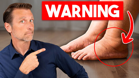 Your Legs Are Failing First — Here’s Why