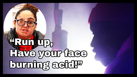 Man Arrested For Throwing Acid In Woman's Face After Rapping About It