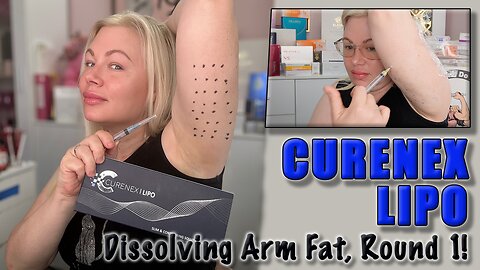 Curenex Lipo Arm Fat Dissolving, Round 1! AceCosm.com and code Jessica10 Saves you money
