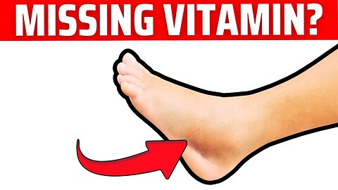 #1 Nutrient to Reduce Swelling in Feet, Legs and Ankles