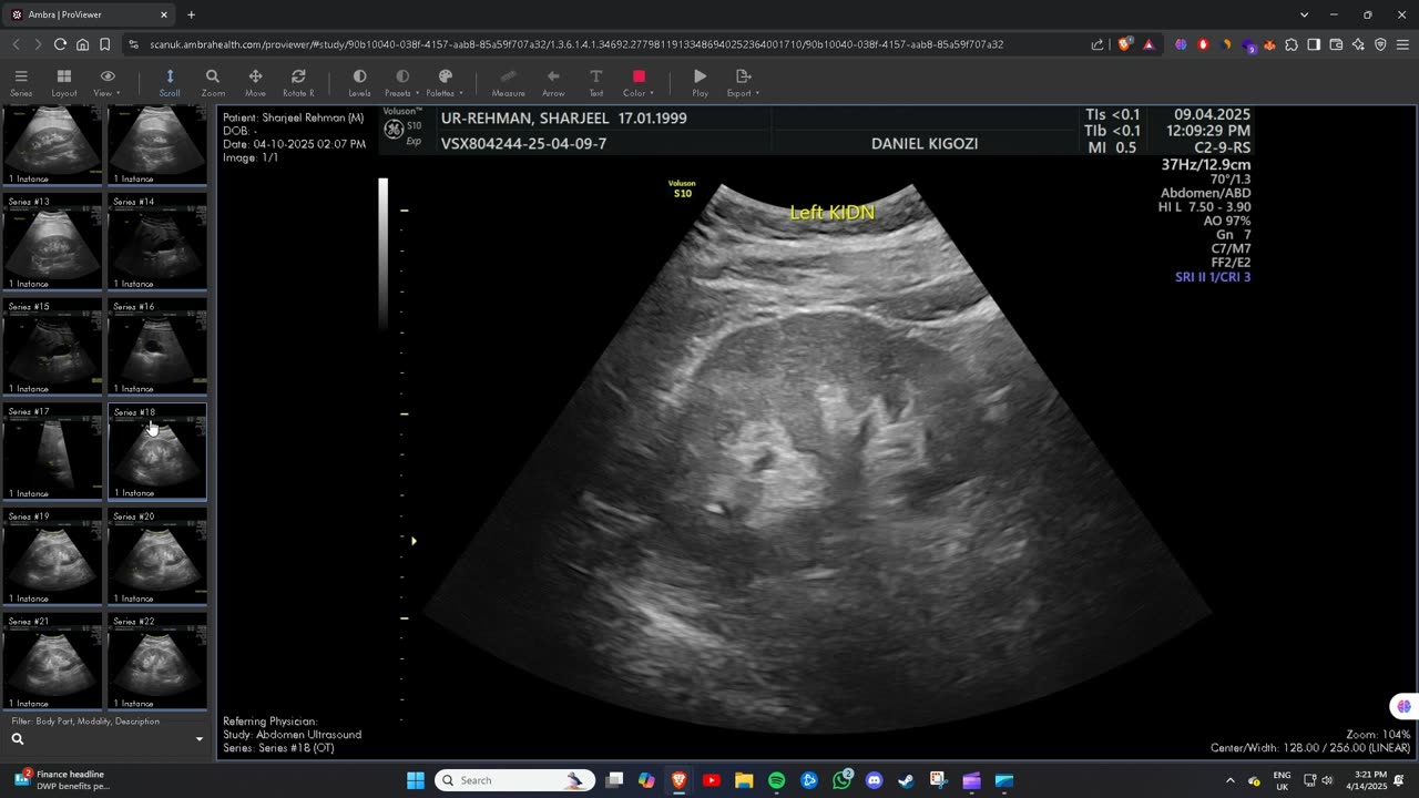Ultrasound Scan Images