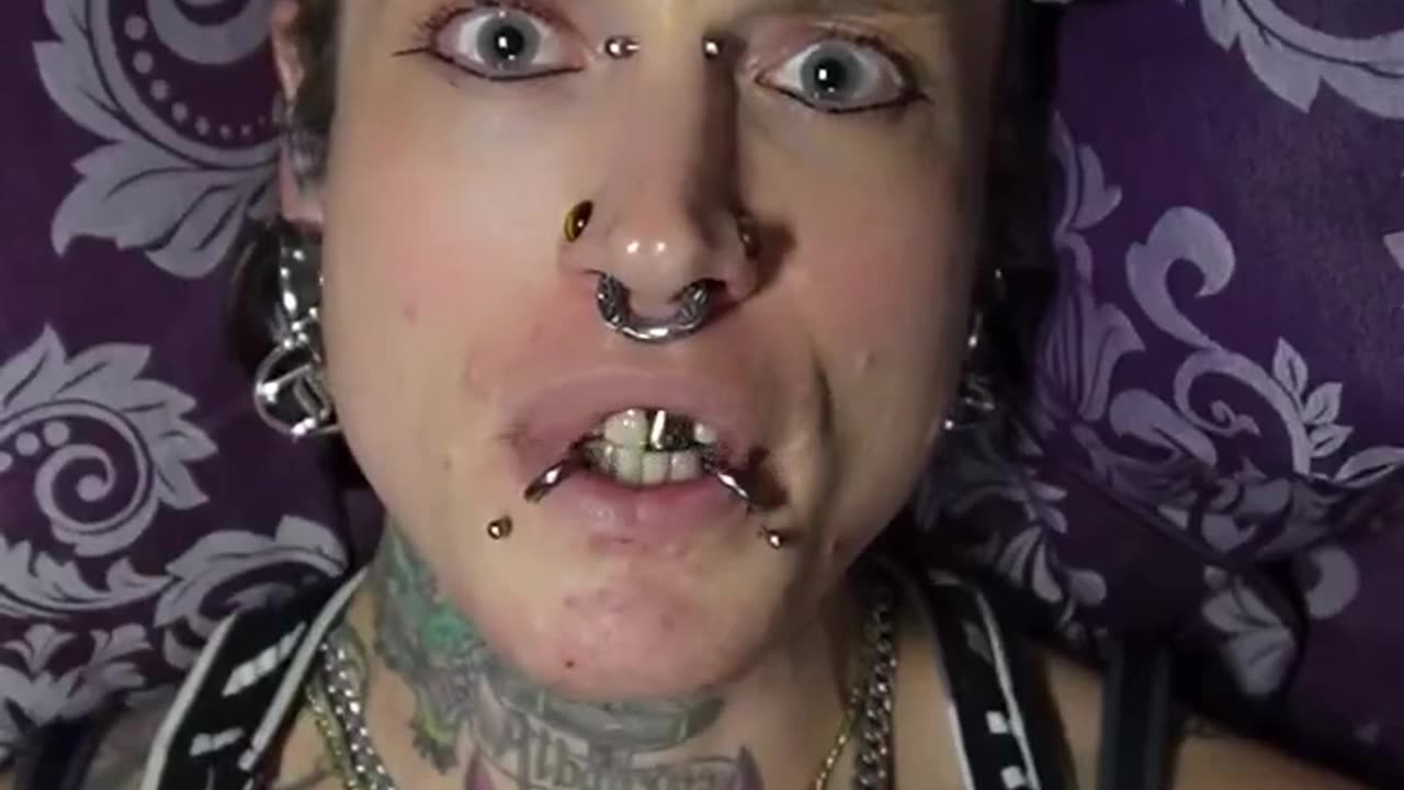 Retard alert