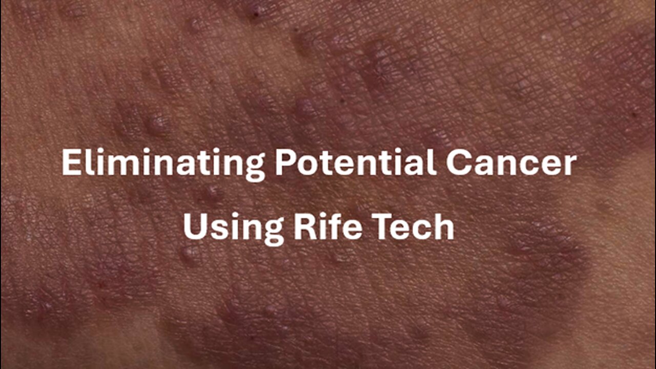 Eliminating Potential Cancer Using Rife Technology