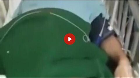 Another Vaccine Casualty. Graphene Oxide will do that.