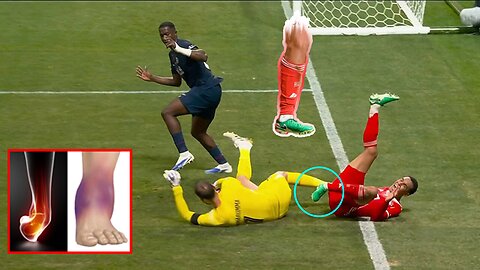 Jamal Musiala sustains a significant injury as of the FIFA World Cup 2025 season