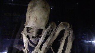 Complete Elongated Skull Skeleton In An Obscure Small Museum Near Lake Titicaca In Bolivia