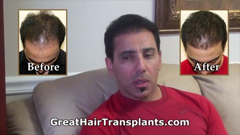 Dr. Brett Bolton Fitness Trainer to Professional Athletes and Celebrities Gets His Hair Restored