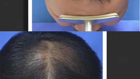 Hair Loss Secrets THEY Don’t Want You To Know!